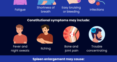 Common Myelofibrosis Symptoms