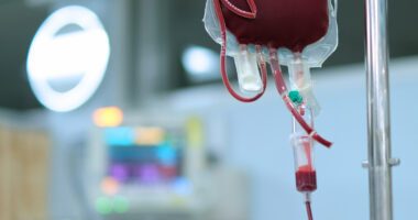A bag of blood is hung on an infusion stand in a hospital care unit, ready for use in a patient.