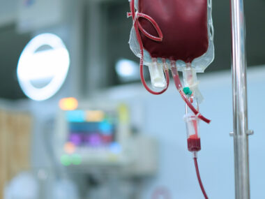 A bag of blood is hung on an infusion stand in a hospital care unit, ready for use in a patient.