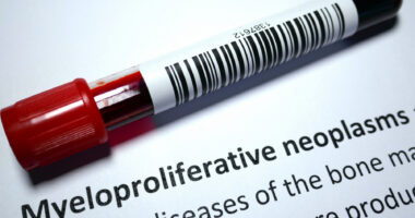 An image of a blood sample tube resting on a page labeled “Myeloproliferative neoplasms.”