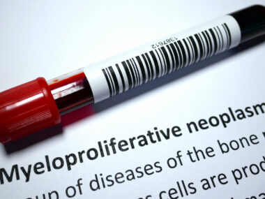 An image of a blood sample tube resting on a page labeled “Myeloproliferative neoplasms.”