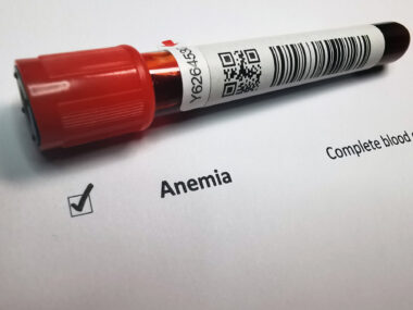 A vial of labeled blood sits on a sheet of paper that shows a checked box indicating anemia.